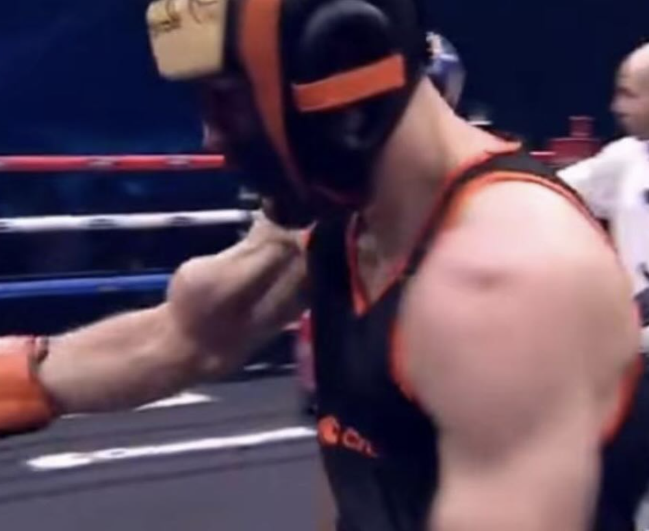 Byilhan se blesse au tendon du biceps pendant son combat de Boxe face à Brawks au DTR Fight