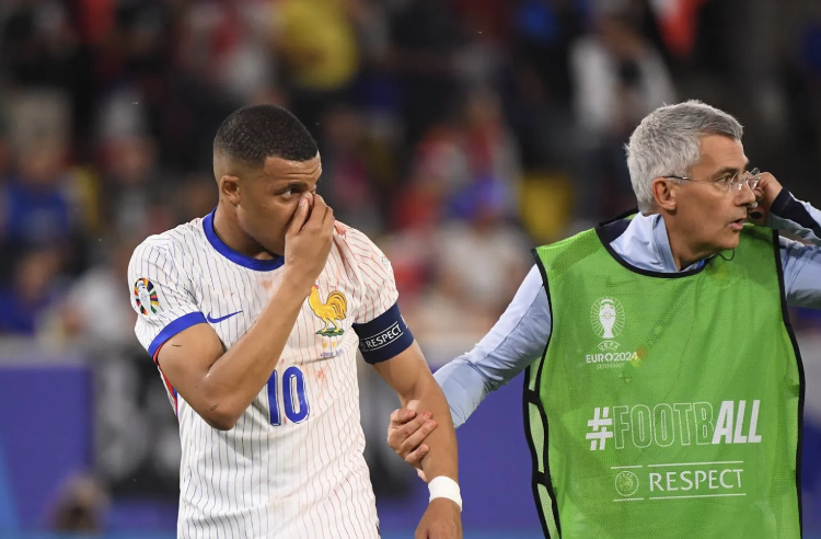 Kylian Mbappé qui sort avec le nez en sang face à l’Autriche à l’Euro 2024 